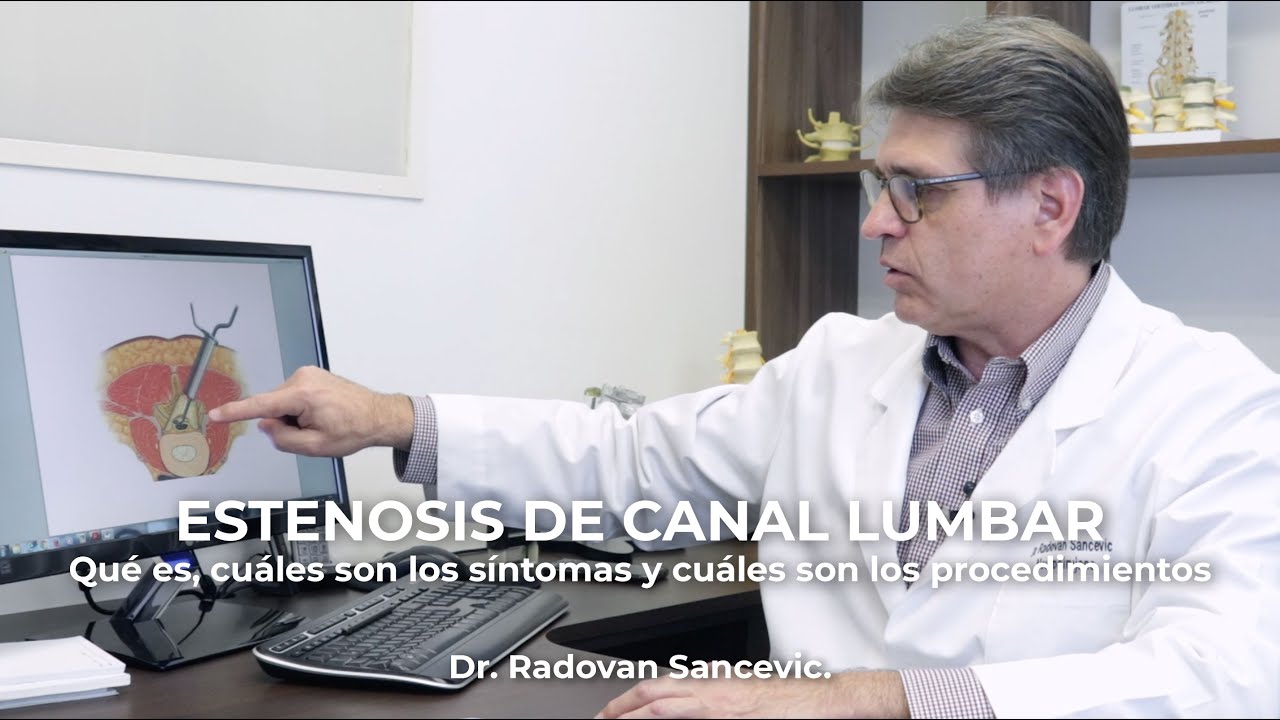 ¿Qué es la Estenosis de Canal Lumbar?