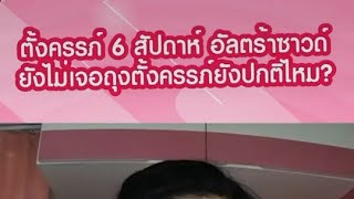 6 สัปดาห์ ซาวด์ยังไม่เจอถุงการตั้งครรภ์ ผิดปกติไหม?