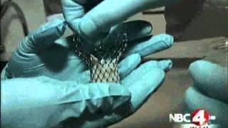 OhioHealth's Riverside Methodist Hospital Participates in Medtronic CoreValve U.S. Clinical Trial