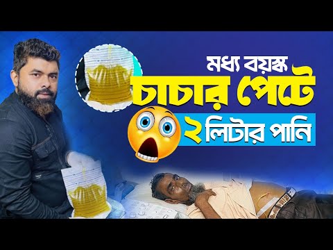মধ্য বয়স্ক চাচার পেটে ০২ লিটার পানি | Dr Saiful Islam Saif Sonography
