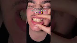 Havent Seen Anything Like This Before This Is Crazyyy