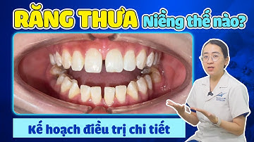 Ca Niềng Răng Thưa Phức Tạp: Kế Hoạch Điều Trị Tính Toán Đến Từng Milimet | Nha khoa Lạc Việt Intech