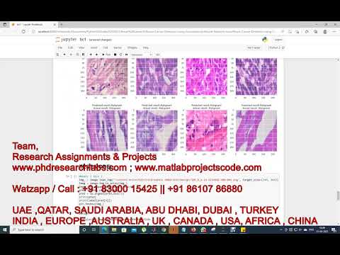 Histopathological Images for Prediction of Breast Cancer Using python code | Breast cancer