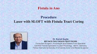 Fistula In Ano
