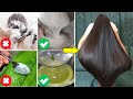 Double Hair Growth Secret Remedy & Tricks | Stop This Mistakes & Grow Your Hair Overnight