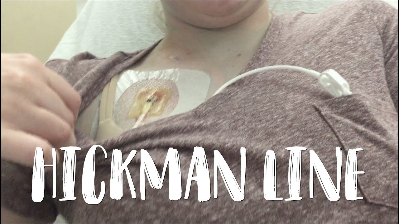 Another Hickman Line Placement Chronic Illness Vlog YouTube