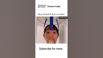 How Dentel X-rays taken #youtubeshorts #xray #dental #ytshorts #shorts #fyp