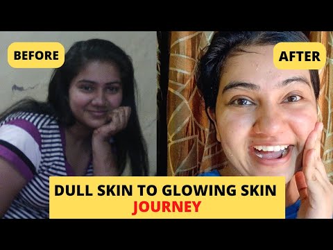 My Dull Skin to Glowing Skin Journey   Khushbu Sharma