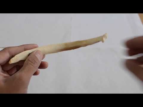 11TH RIB - IDENTIFICATION AND SIDE DETERMINATION