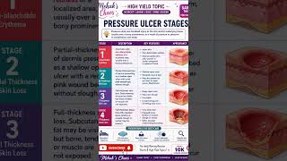Pressure ulcer stages quick revision#norcet #pyqs #norcetmcq #rrb#nurse