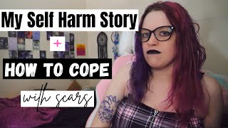 My Self Harm Story & How I Cope With Scars