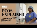 PCOS, Symptoms and Management 