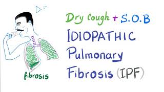 Idiopathic Pulmonary Fibrosis | Restrictive Lung Disease | Pulmonology