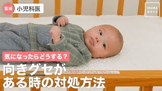 気になったらどうする？向きグセがある時の対処方法