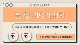 (부산성형외과) 수술 후 복시 현상이 생겼어요! 해결 방법?