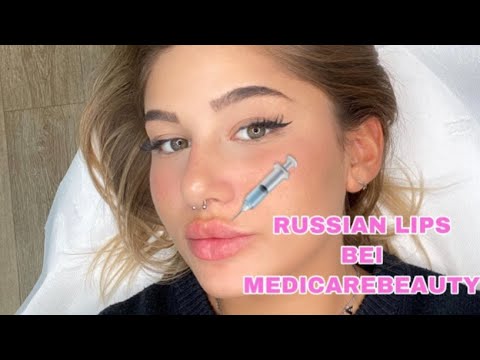 RUSSIAN LIPS bei MedicareBeauty VLOG // Vorher - Nachher, Preis, Schmerzen