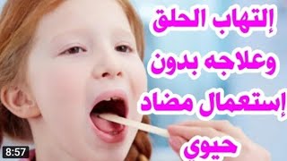 علاج إلتهاب الحلق بدون مضاد حيويمع د/عبدالرحمن مسعد