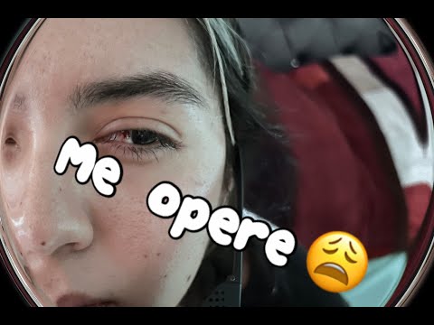 ME ACABAN DE OPERAR 😰?