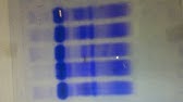 ImageJ for Editing & Labelling PCR Gel Image | Biotechnology ...