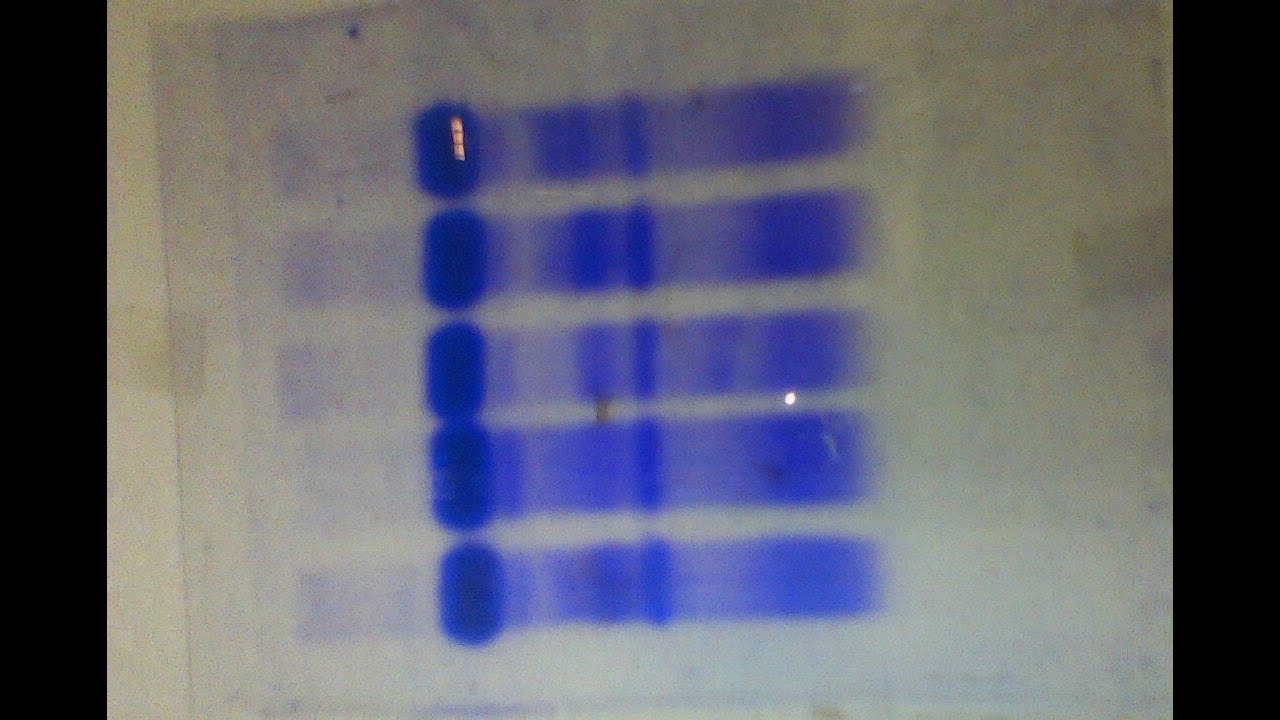 Quantify protein bands on agarose gel using Image J software YouTube