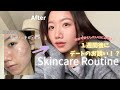 デート1週間前から仕込む、特別な日のためのスキンケアルーティン🫧✨