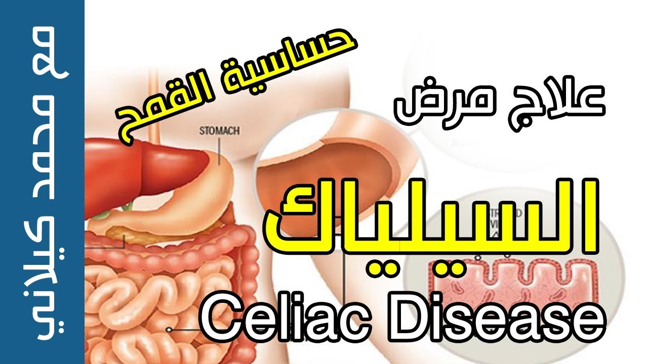 علاج مرض السيلياك حساسية القمح سهل جدا Youtube