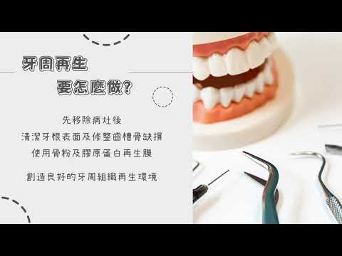 樂心牙周專科+牙周再生手術+