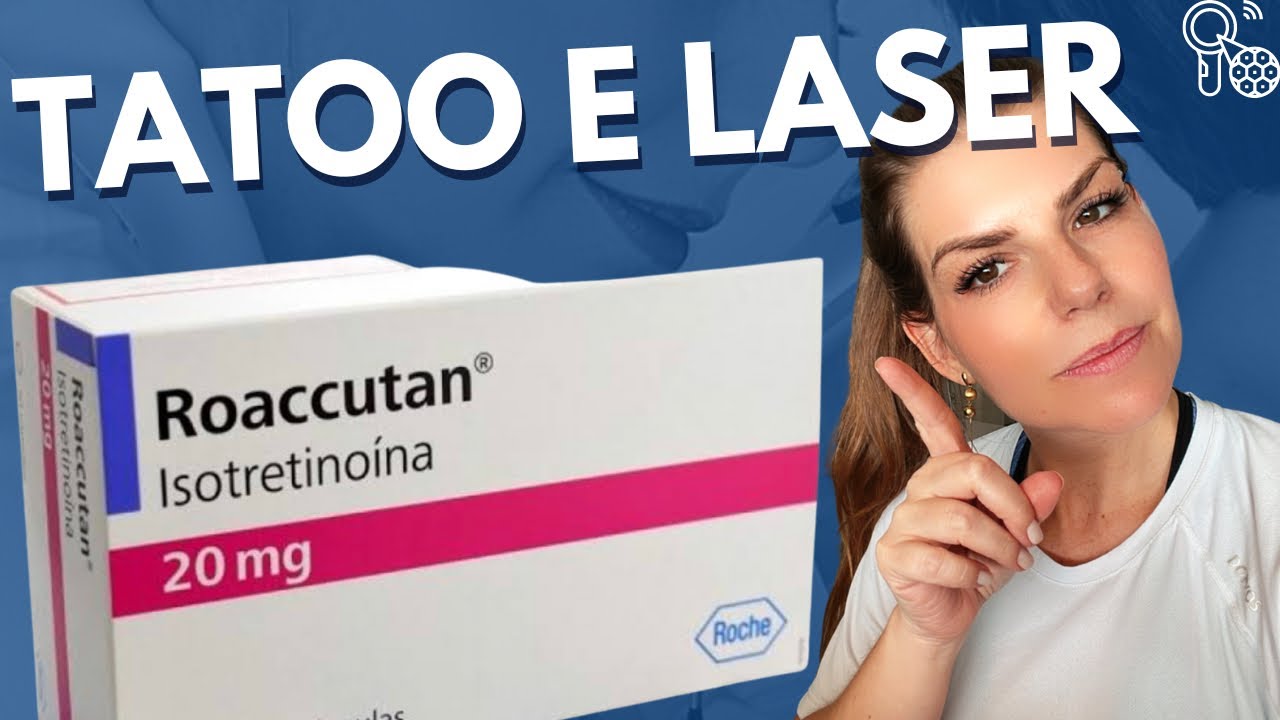 Posso fazer tatuagem e depilação tomando Roacutan? - YouTube