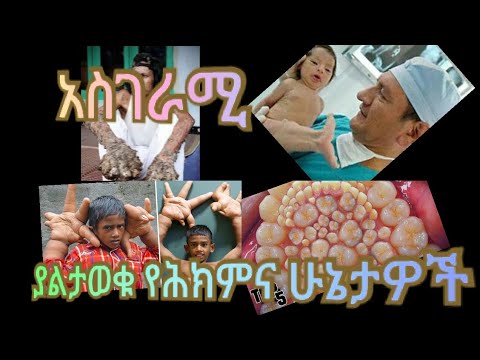 ቪዲዮ: አይሶቶፖችን እንዴት ማስተዋወቅ ይቻላል?