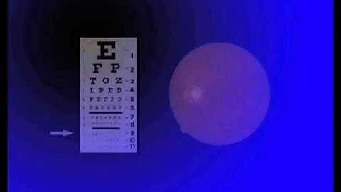 Visual Acuity - The 15 Visual Problems of Macular Degeneration