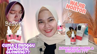 Review Glowtening serum scarlett whitening | Review serum produk lokal untuk mencerahkan wajah