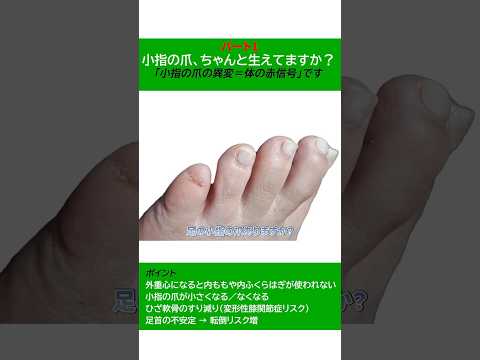 小指の爪がない人 O脚 “老化の赤信号” パート1