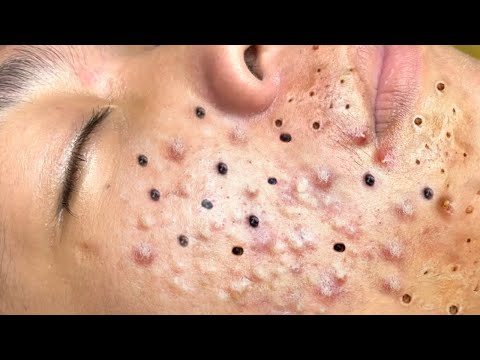 Видео: Relaxing Everyday With Loan Nguyen Skincare