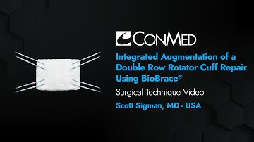 Integrated Augmentation of a Double Row Rotator Cuff Repair using BioBrace®  - CONMED Technique