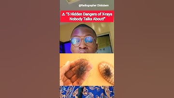 ⚠️ “5 Hidden Dangers of X-rays Nobody Talks About!”#viralreels #fypシ #radiography #health #XRay