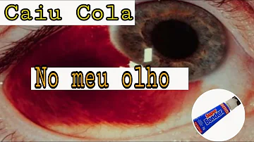 Como tirar cola de dentro do olho?
