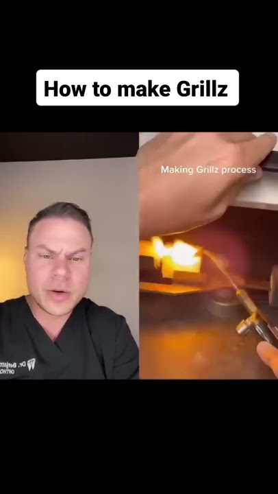 How Grillz Are Made
