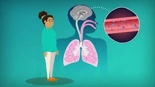 4   Why does apnoea occur in babies?