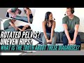 Rotated Pelvis? Uneven Hips? What is the TRUTH about these diagnoses?