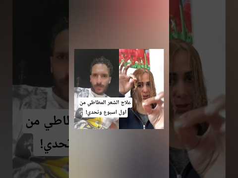علاج الشعر المطاطي من اول اسبوع وتحدي