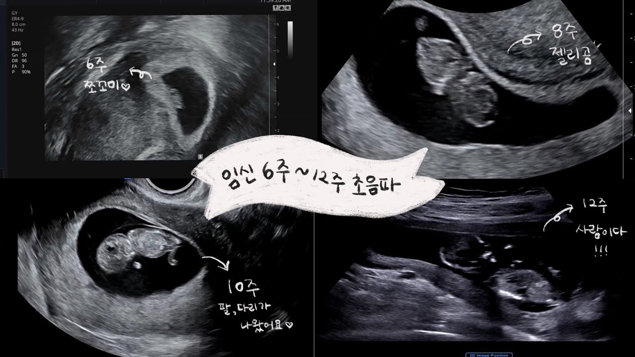 [임신vlog] 임신 6주, 8주, 10주, 12주 초음파 영상 모음집👼💗ㅣ태아 성장과정ㅣ아기천사ㅣ임신기록ㅣ임신ㅣ임산부ㅣ흑호랑이