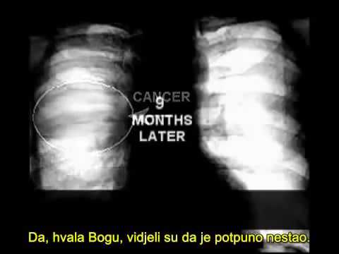 Izliječeni od raka pluća