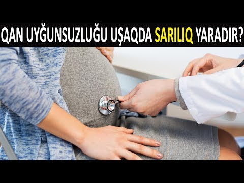 Video: Doğmamış Uşağın Qan Qrupunu Necə Təyin Etmək Olar