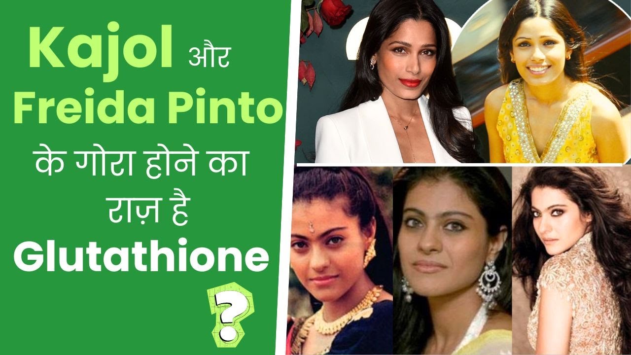 kajol glutathione treatment Kajol और Freida Pinto के गोरा होने का राज़ है Glutathione? Understanding  Cosmetology I Dr. Prabha