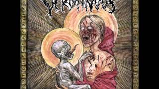 Watch Verminous Impious Genocide video