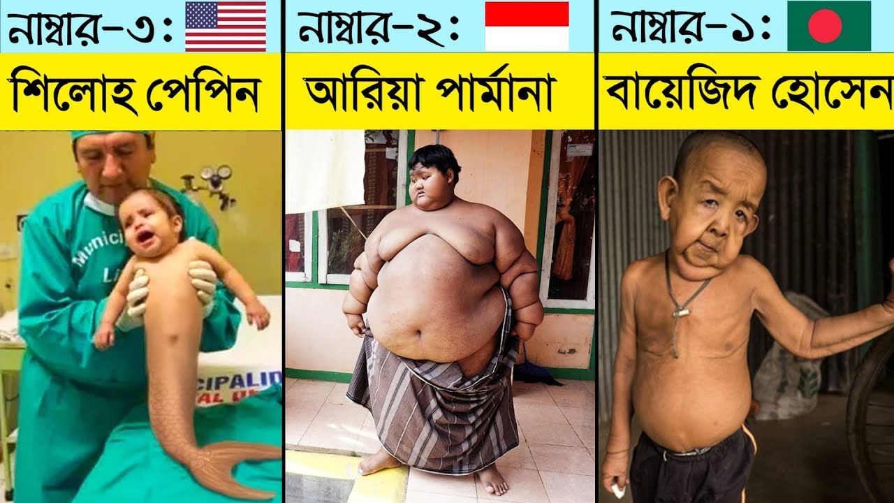 বিশ্বের সবচেয়ে অদ্ভুত শিশু যাদের আগে কোনোদিন দেখেননি | Unusual Kids In The World