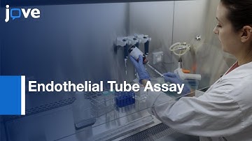 Fibroblast-Derived 3D Matrix System in Endothelial Tube Assay | Protocol Preview