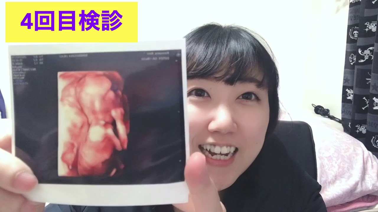 性別判明の瞬間 男の子エコー写真 検診内容 健診費用 妊娠5か月目検診 Youtube
