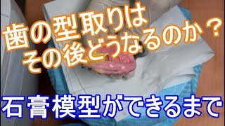 歯型取り後の石膏模型の作り方[English subtitled]牙齿模型,dental impression,tooth model,दाँत का साँचा