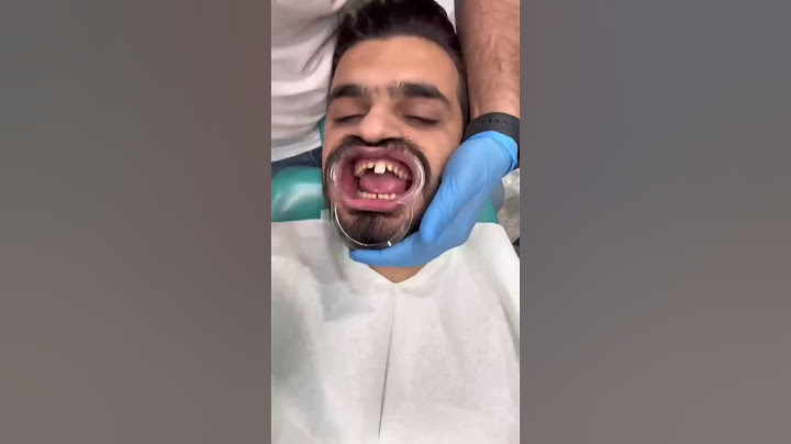 مراحل صناعه ابتسامتي